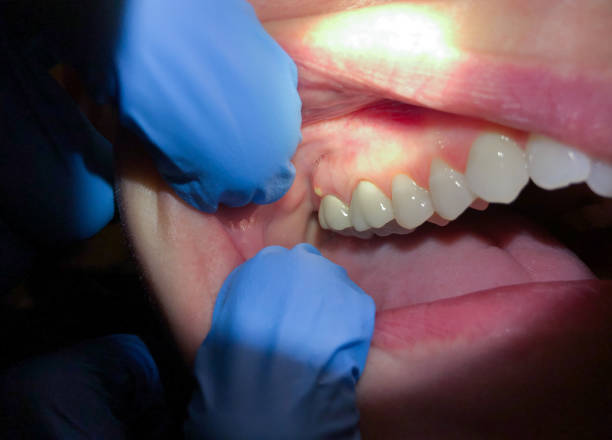 Best Knocked-Out Tooth Emergency  in Rancho Mirage, CA